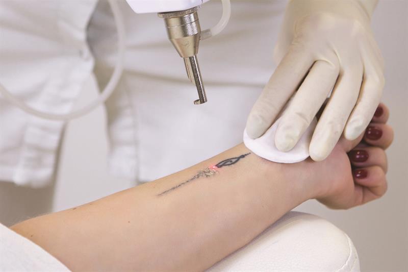 Skin deep The impact of tattoos and piercing on health